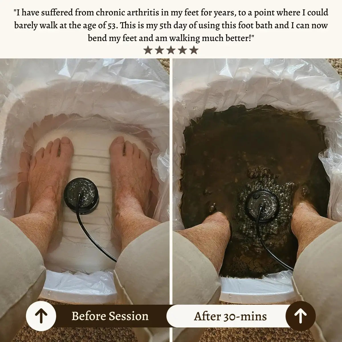 Kozee Ionic Foot Spa
